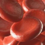 Anemia afecta a mujeres en edad reproductiva