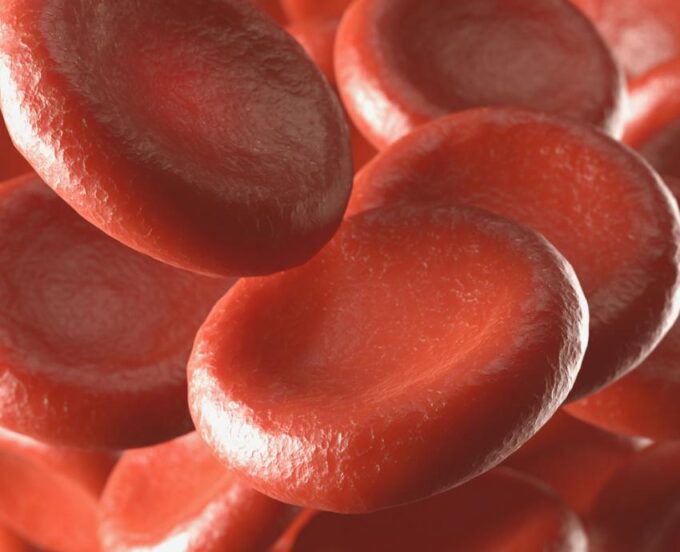 Anemia afecta a mujeres en edad reproductiva